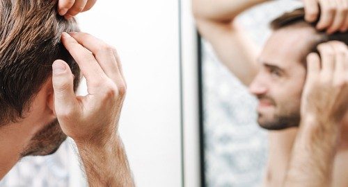 Hair Loss Treatment